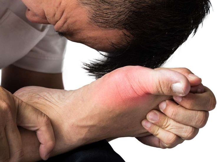 CRPS / RSD