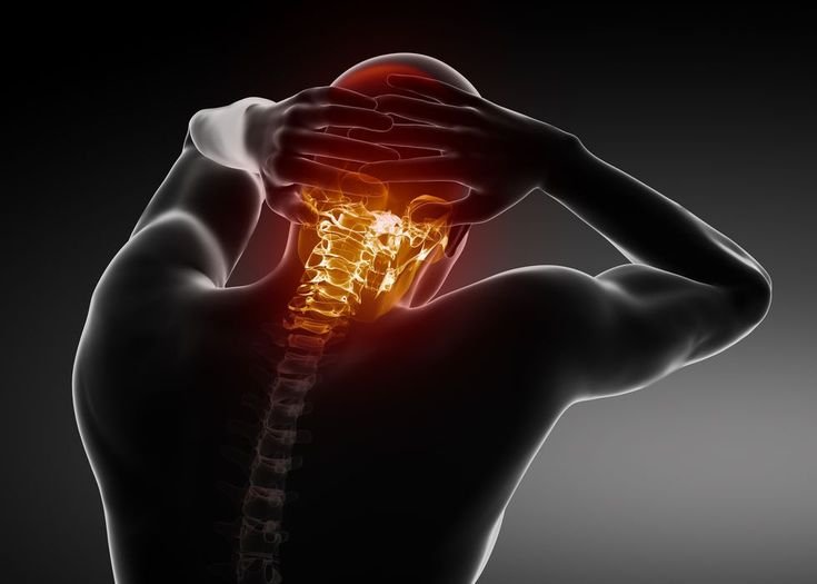 Cervical Spondylosis