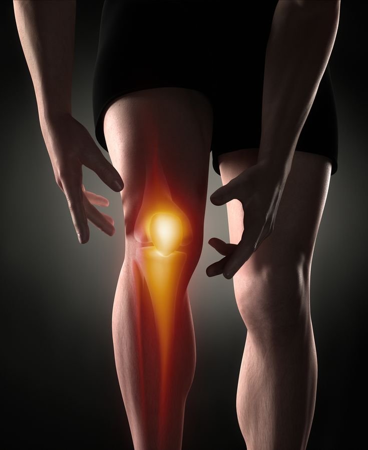 Knee Genicular Nerve RFA