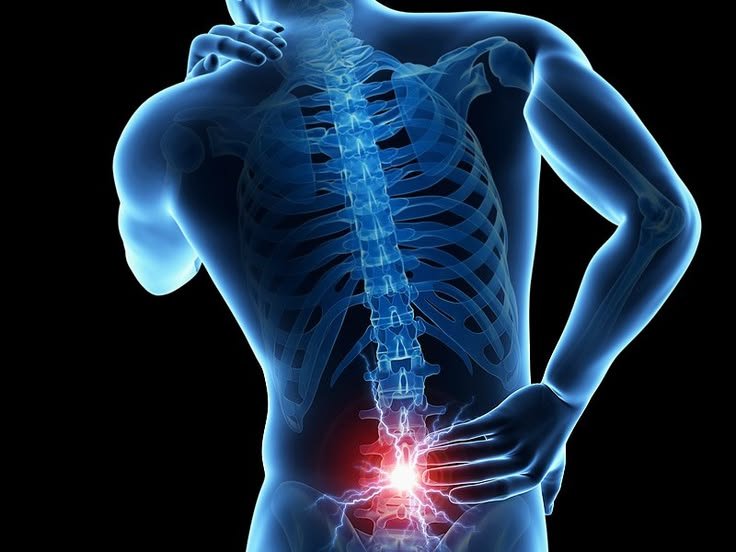 Lumbar Spondylosis