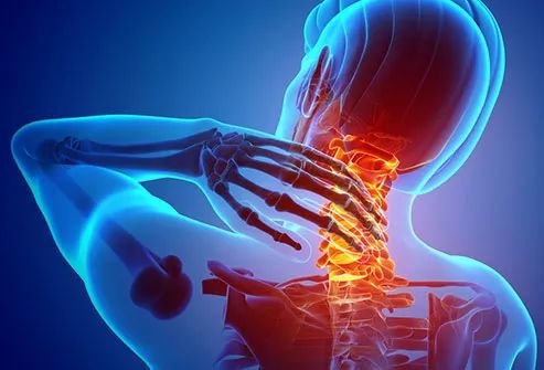 Spinal Canal Stenosis