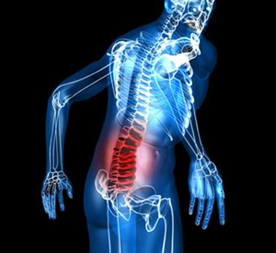 Vertebroplasty