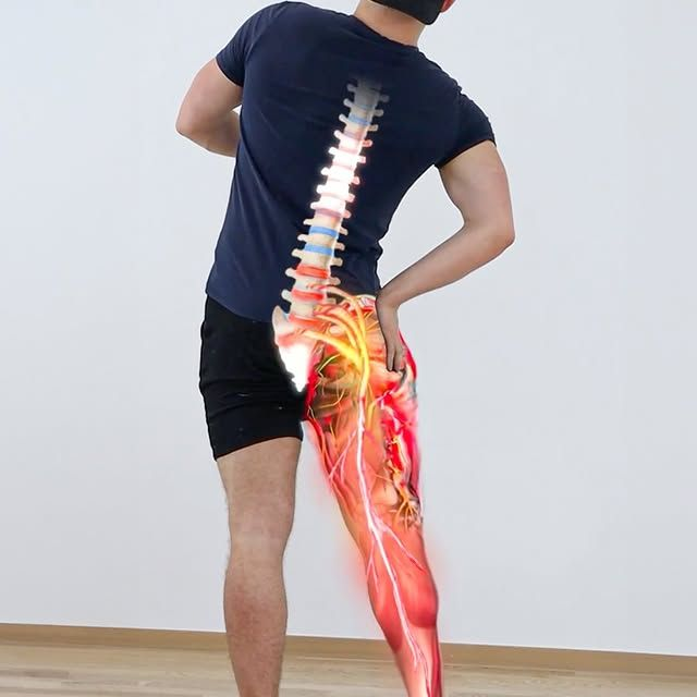 Leg / Sciatica Pain