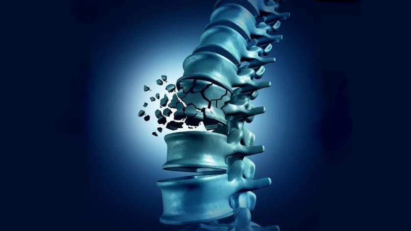 Vertebral / Osteoporotic Fracture