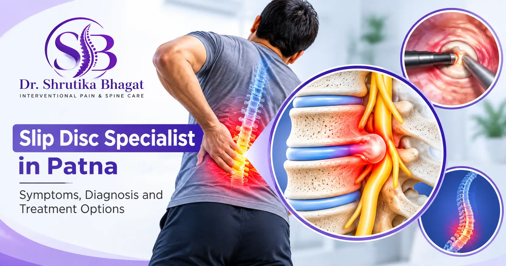 Slip Disc Specialist in Patna: Symptoms, Diagnosis and Treatment Options