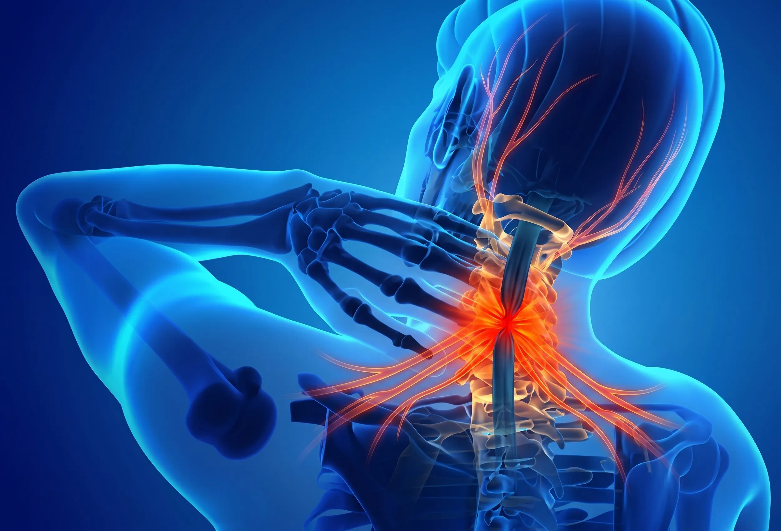 Spinal Canal Stenosis